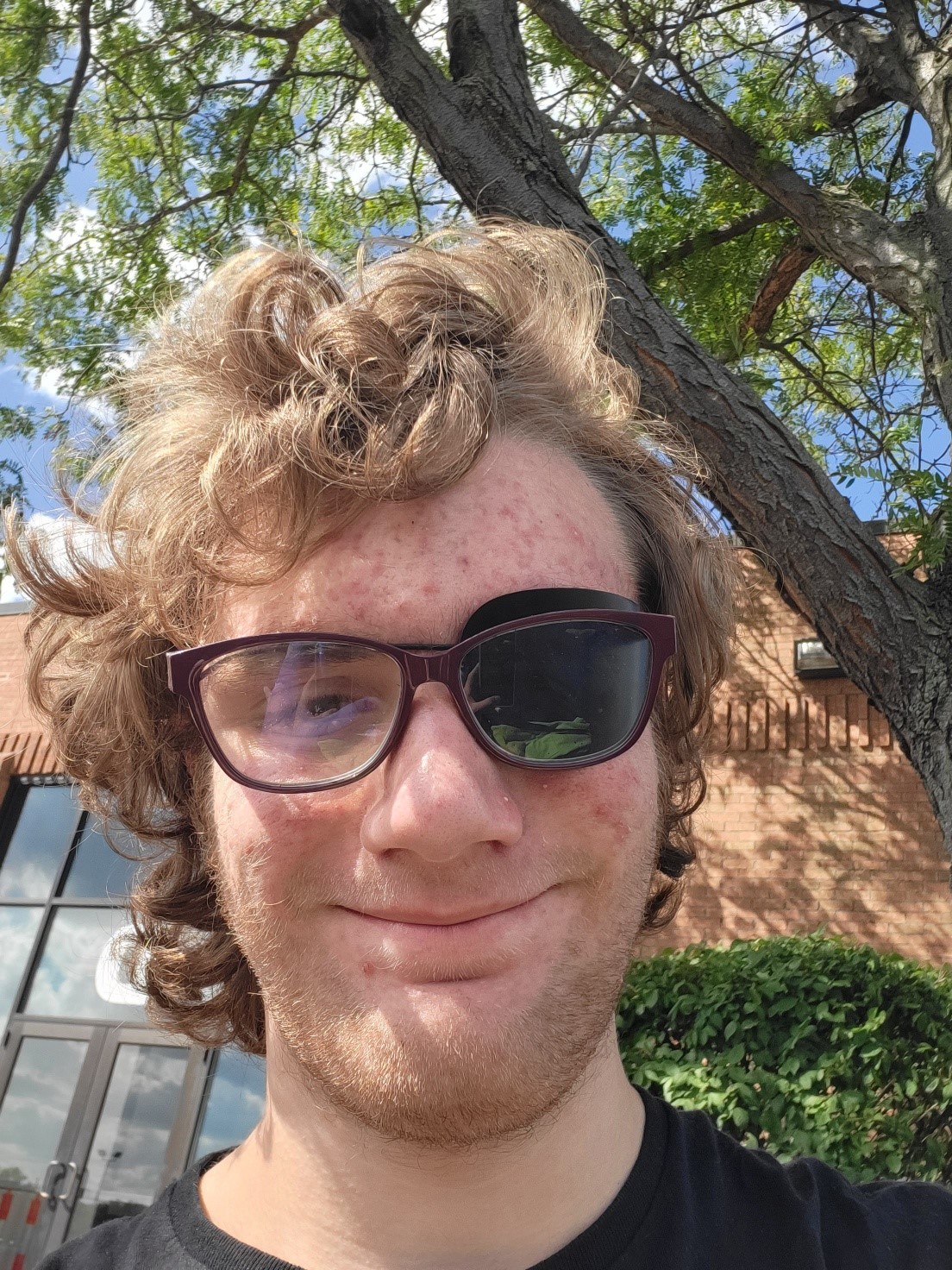 Rio wearing an eyepatch whike outside on a sunny day.